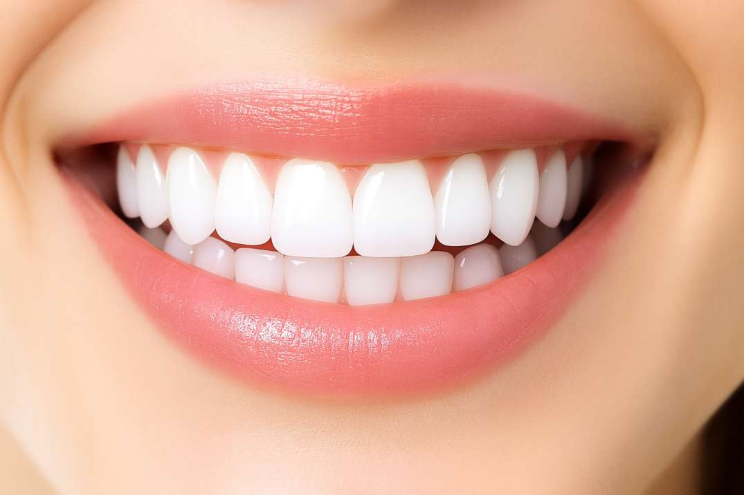 Close-up of a person smiling with bright white teeth and soft pink lips.
