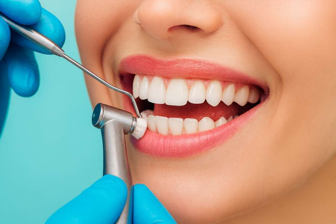 Close-up of a smiling person receiving a dental cleaning with professional dental tools and blue gloves.
