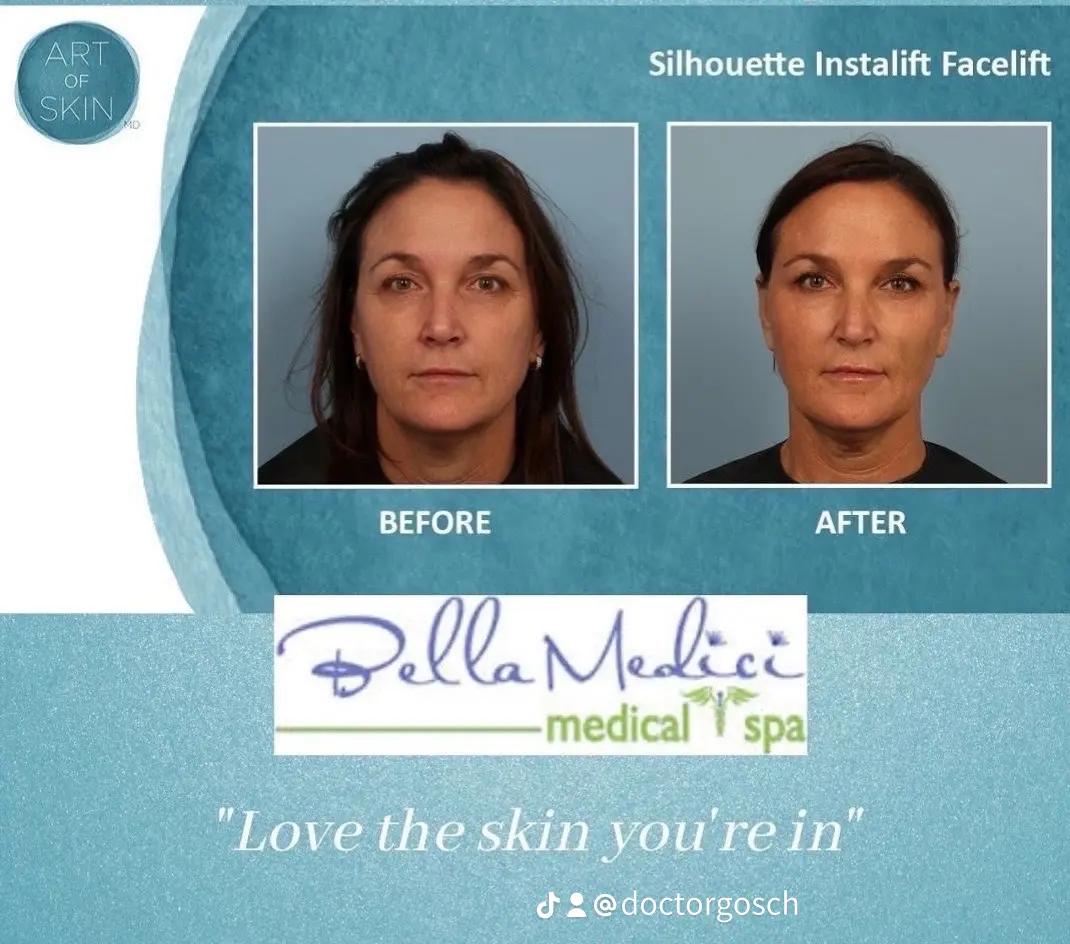 A collage of women before and afterAI-generated content may be incorrect.