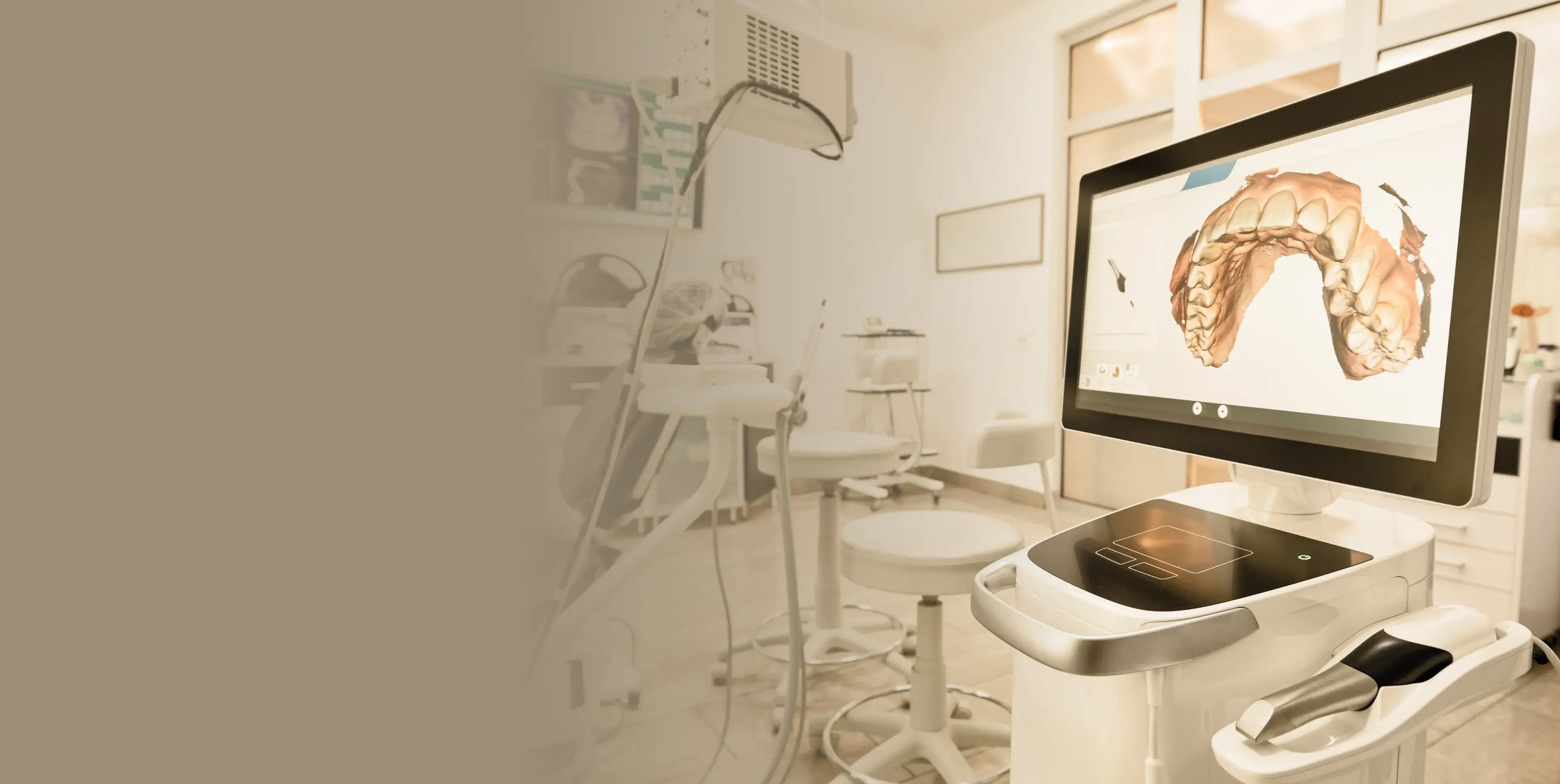 Dental 3D scanner showing a digital model of upper teeth inside a modern dental clinic.