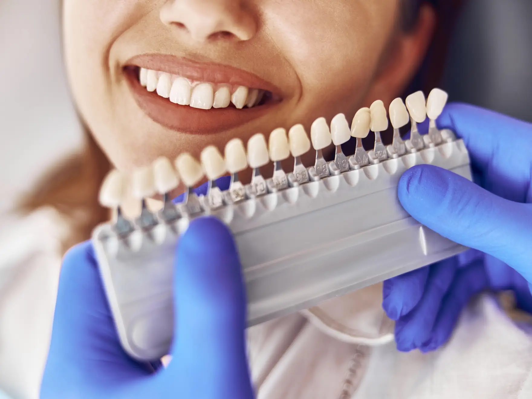 Veeners at Revive Dentistry, Shelby Township, MI