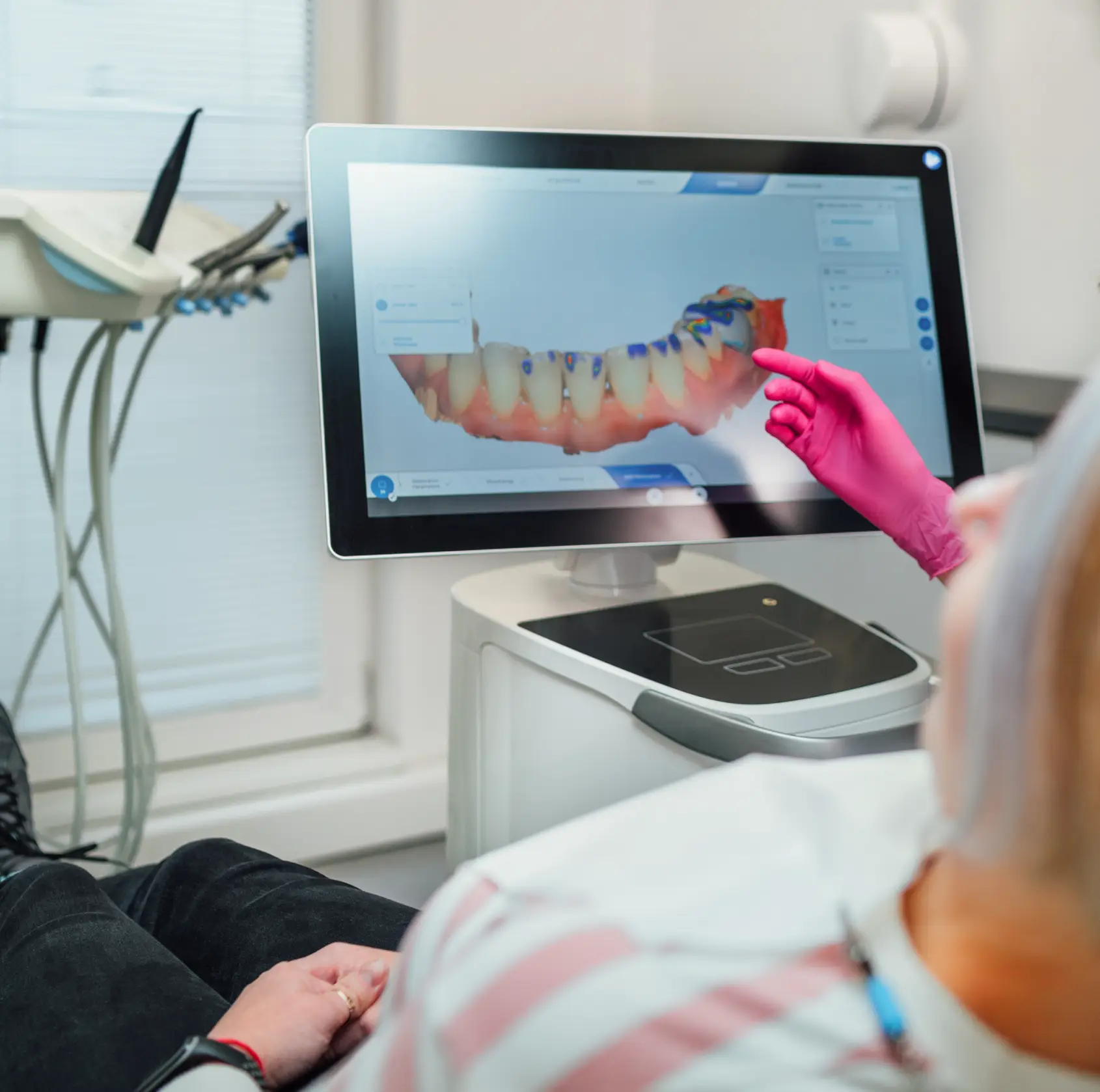 Veeners at Revive Dentistry, Shelby Township, MI