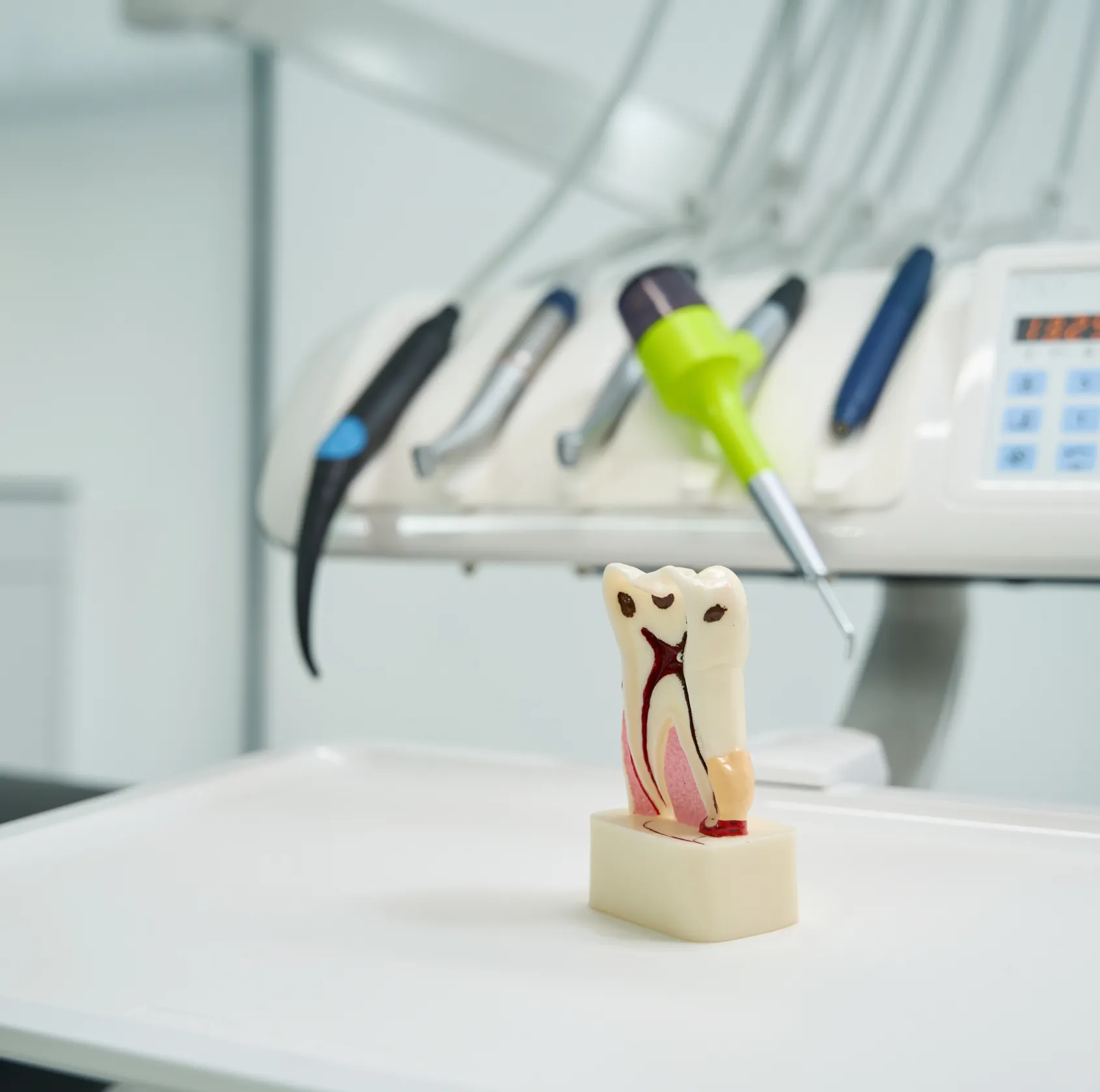 Dental model showing a tooth with root canal infection, set on a dental tray with dental tools in the background.