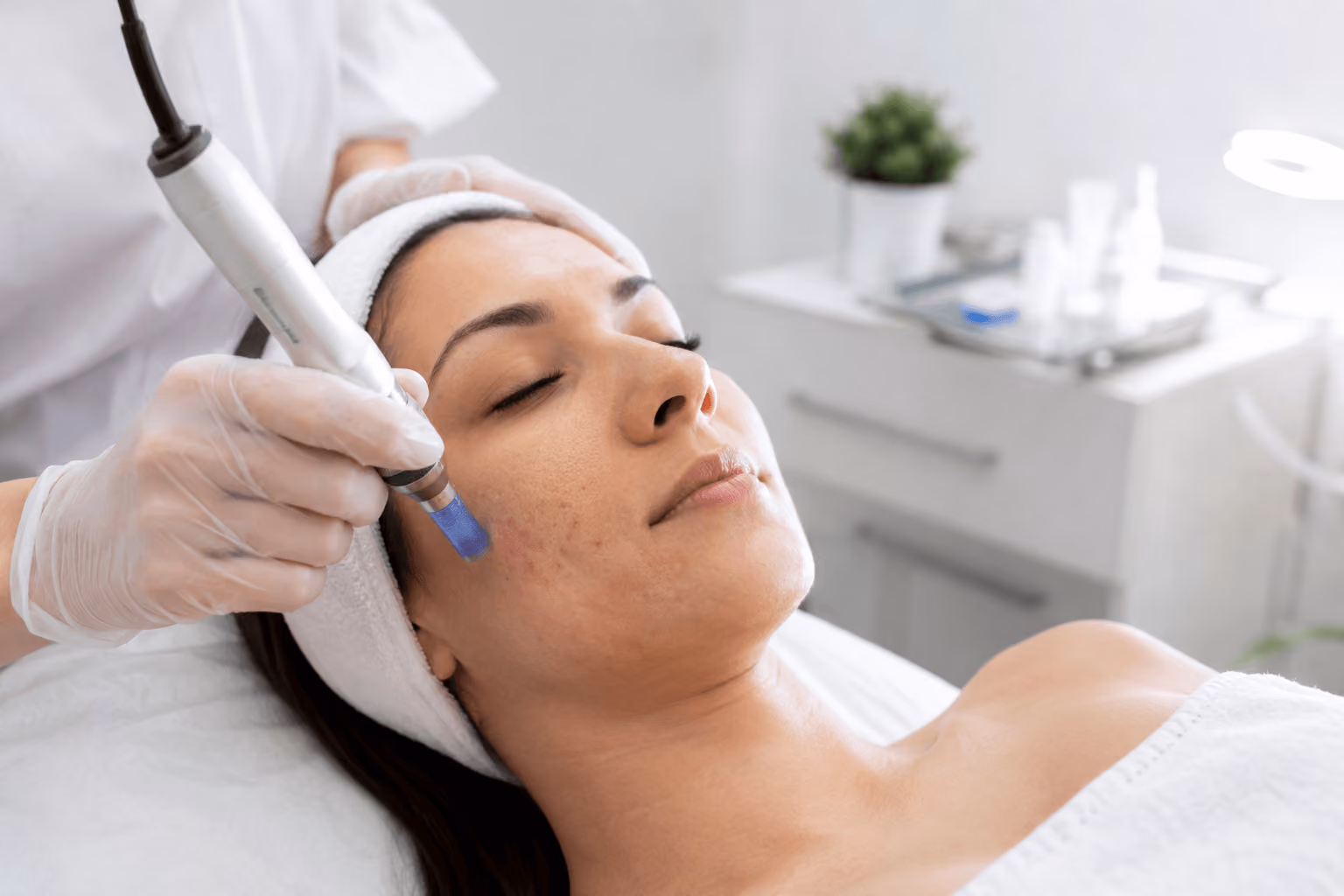 Woman receiving microneedling treatment to improve acne scars and skin texture at a med spa in Cary, North Carolina.