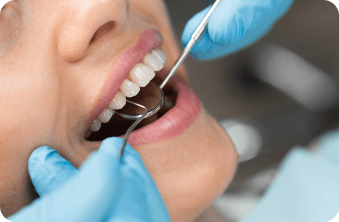 Composite filling dental procedure in Calgary Huntington Family Dental
