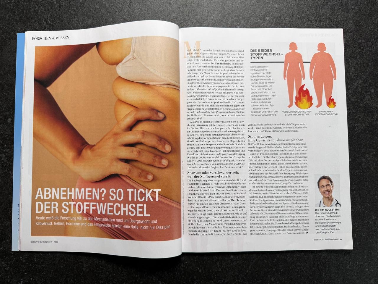 Artikelaufmacher in BUNTE Gesundheit mit dem Titel Abnehmen? So tickt der Stoffwechsel