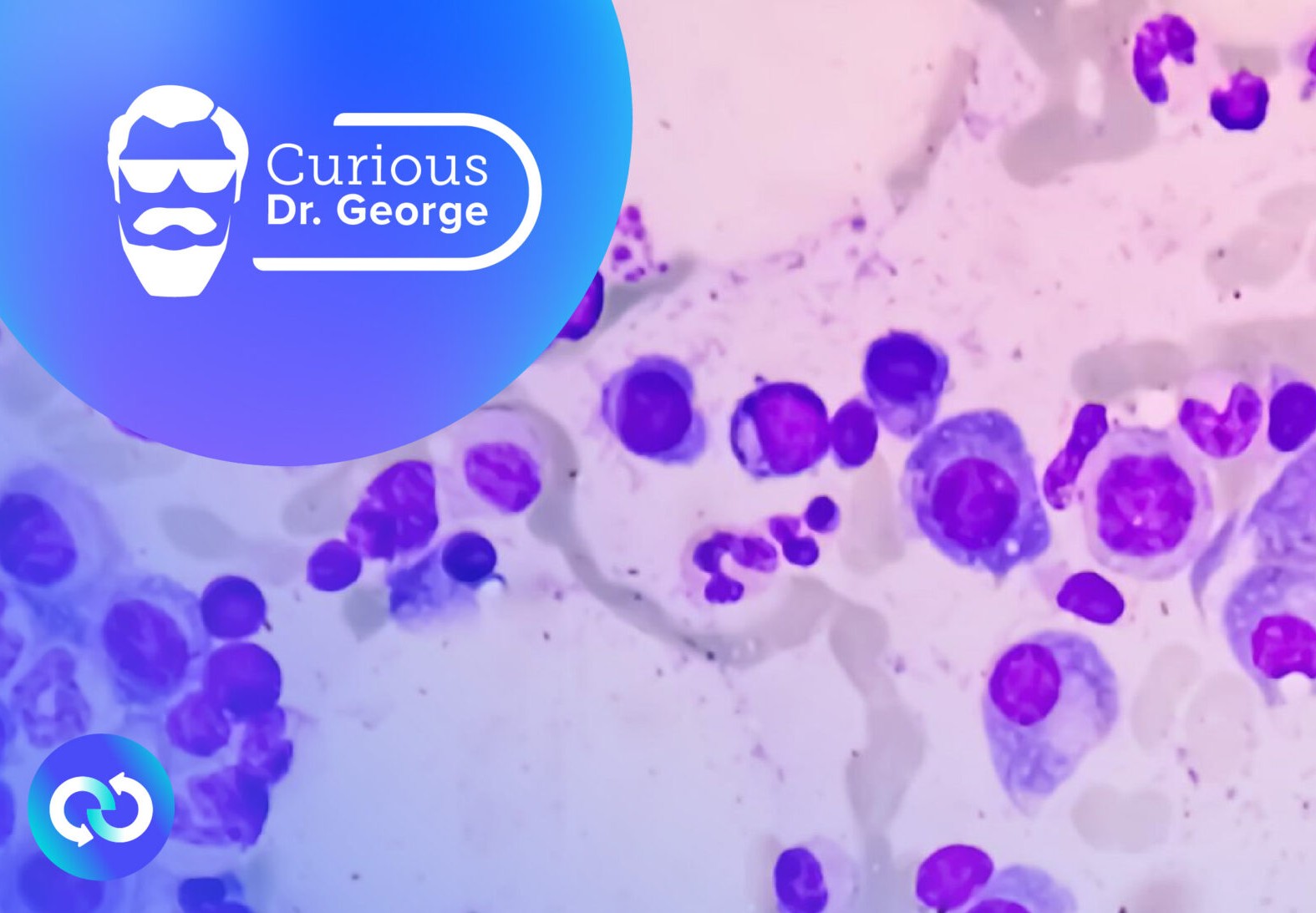 How Would an Expert Manage His Own Acute Myelogenous Leukemia: an Update