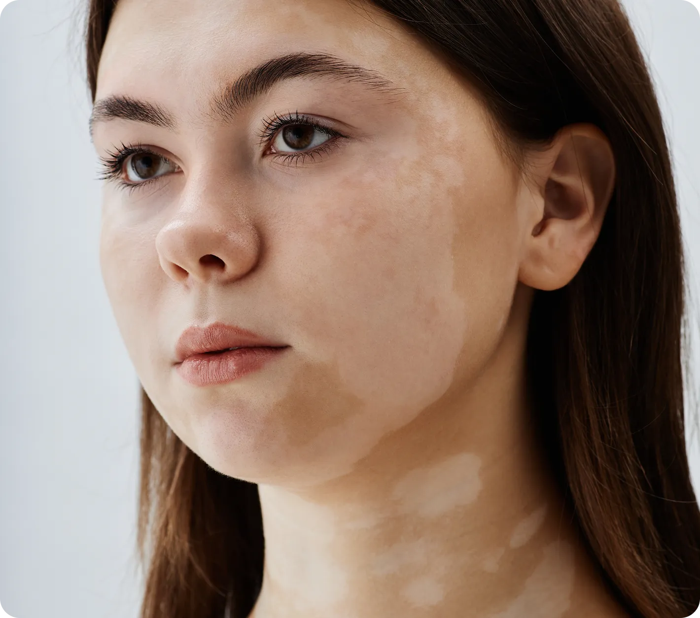 Lifestyle image supporting pigmentation treatment content