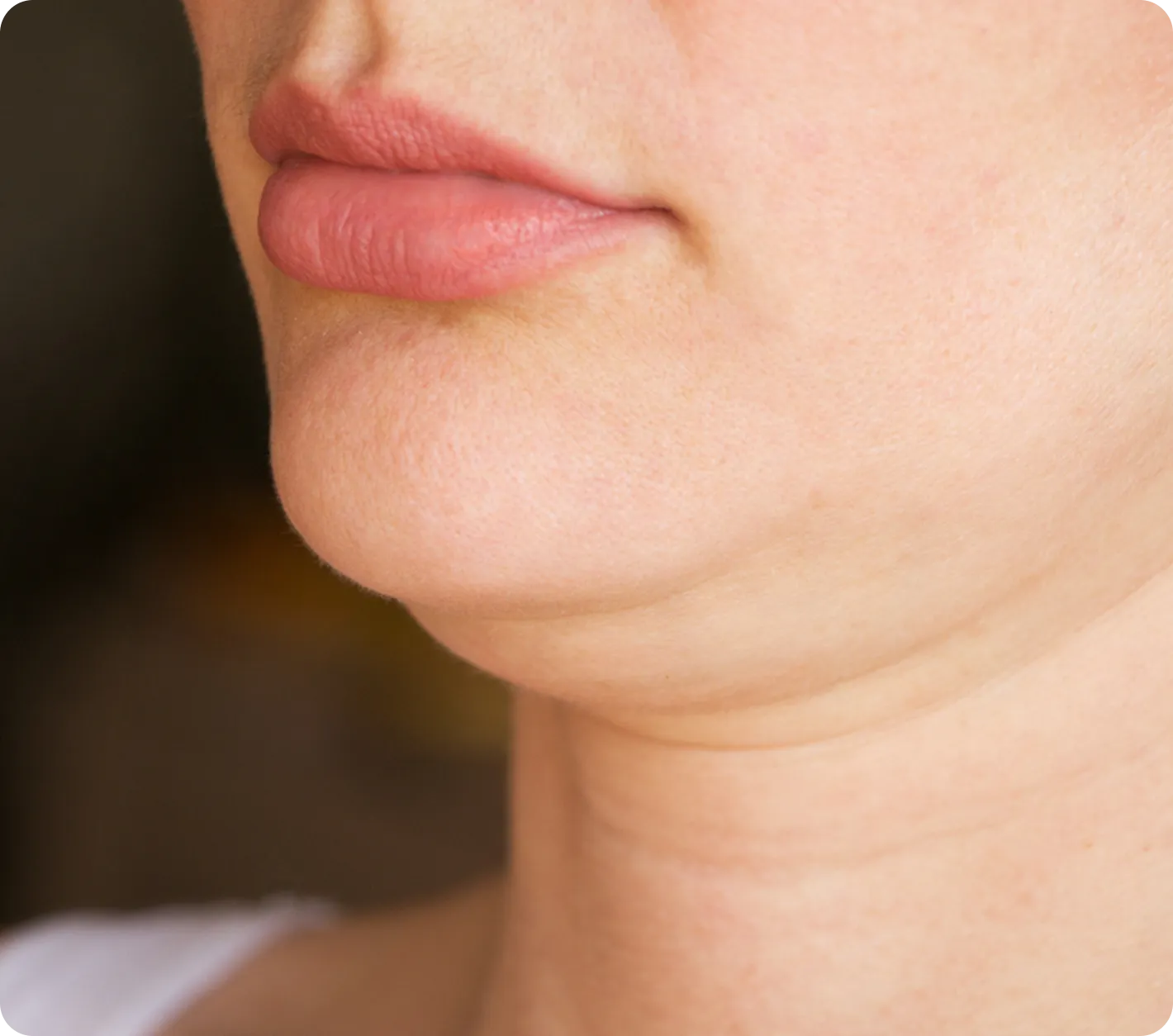 Stubborn Fine Wrinkles 
