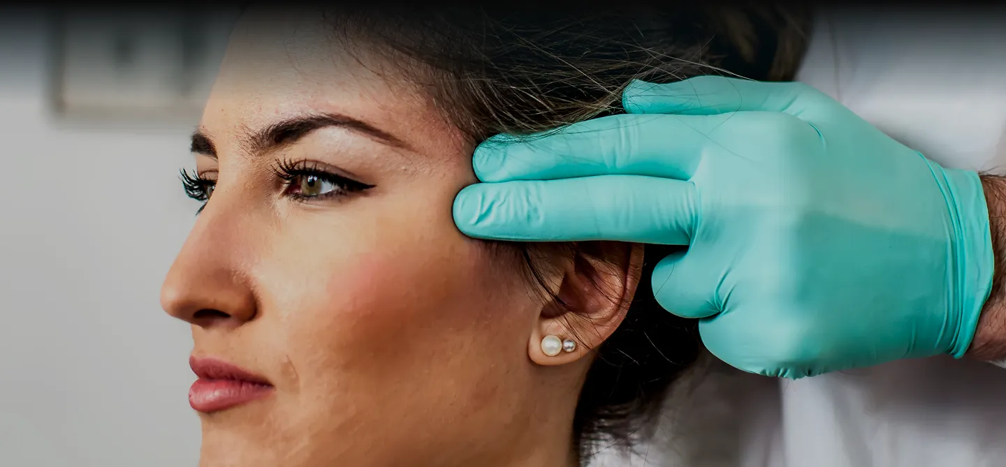 PDO thread lift at AlyneMD