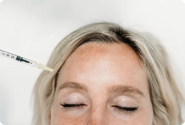 Botox treatment results at AlyneMD — natural wrinkle reduction by Dr. Sandhu in Warren NJ