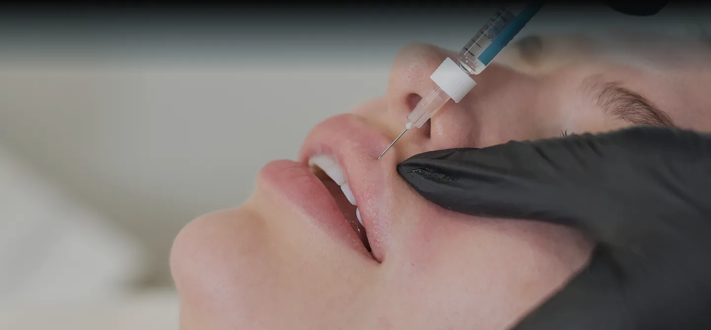Physician-injected dermal fillers at AlyneMD