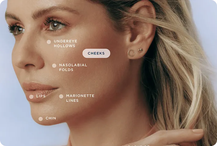 Dermal Fillers