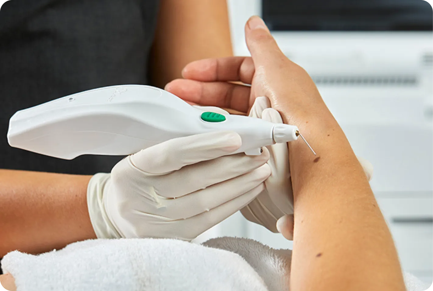 Plexr Plasma Skin Tightening 