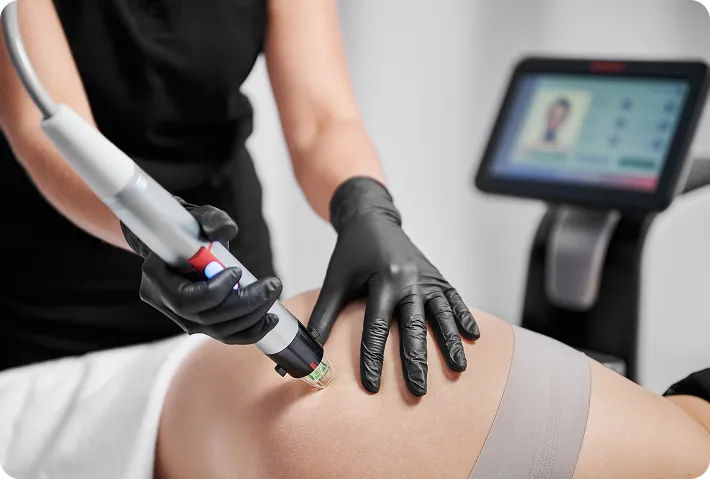 Genius RF Microneedling 