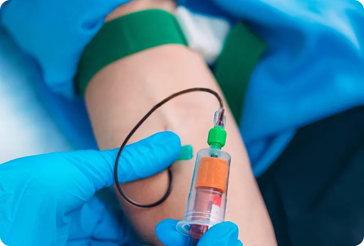 PRP & Exosome Hair Restoration Therapy