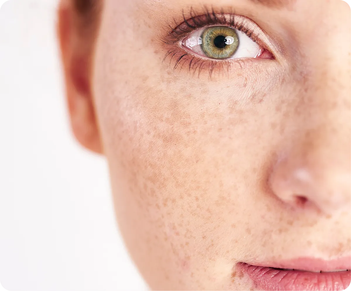 PRP & Exosome Hair Restoration Therapy