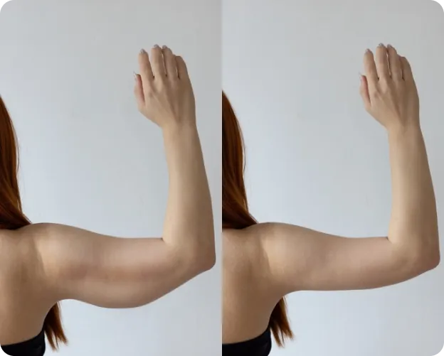 Medical Weight Loss before and after image