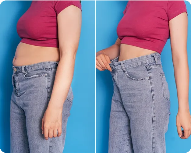 Medical Weight Loss before and after image