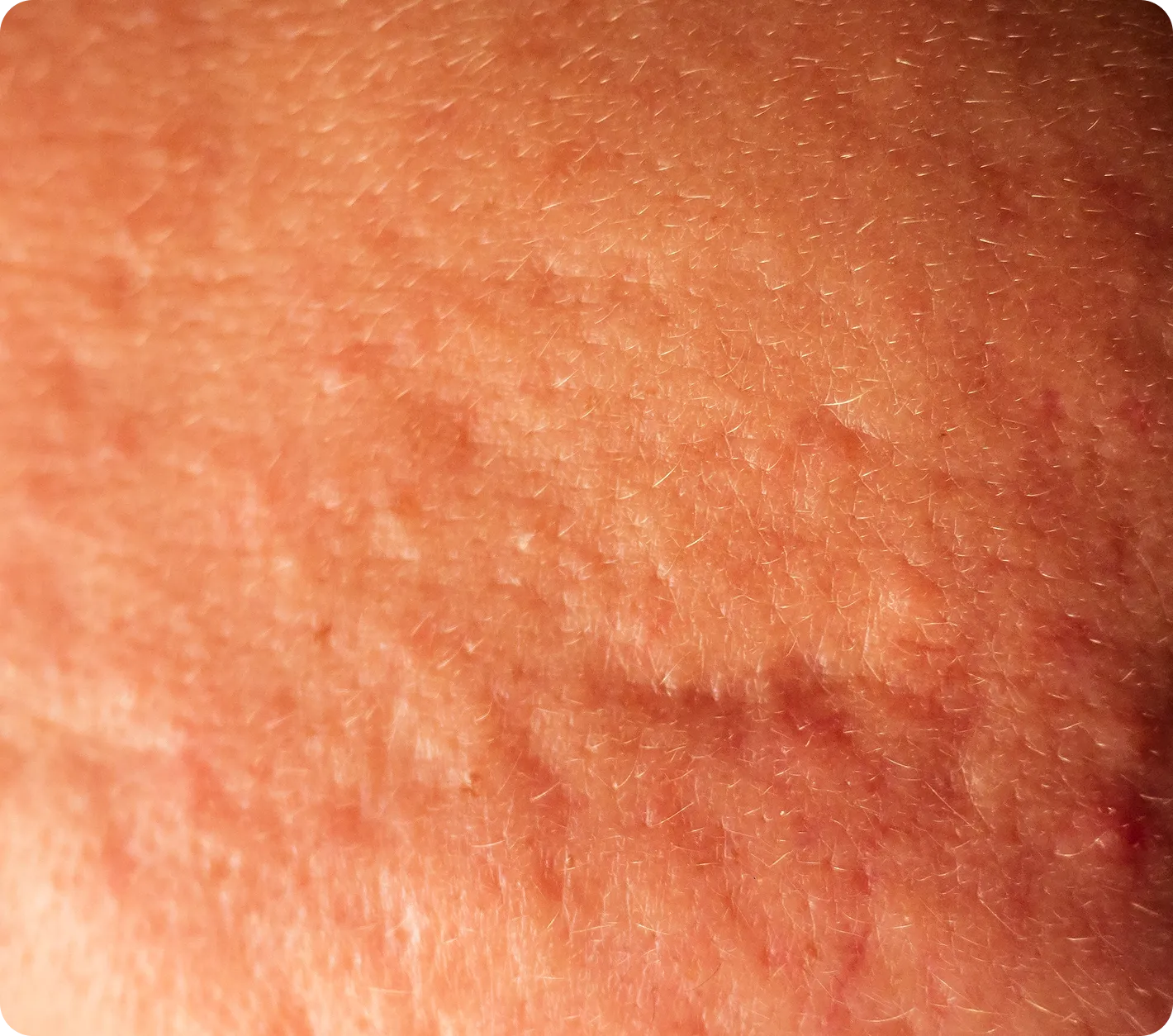 Texture & Pores Treatment
