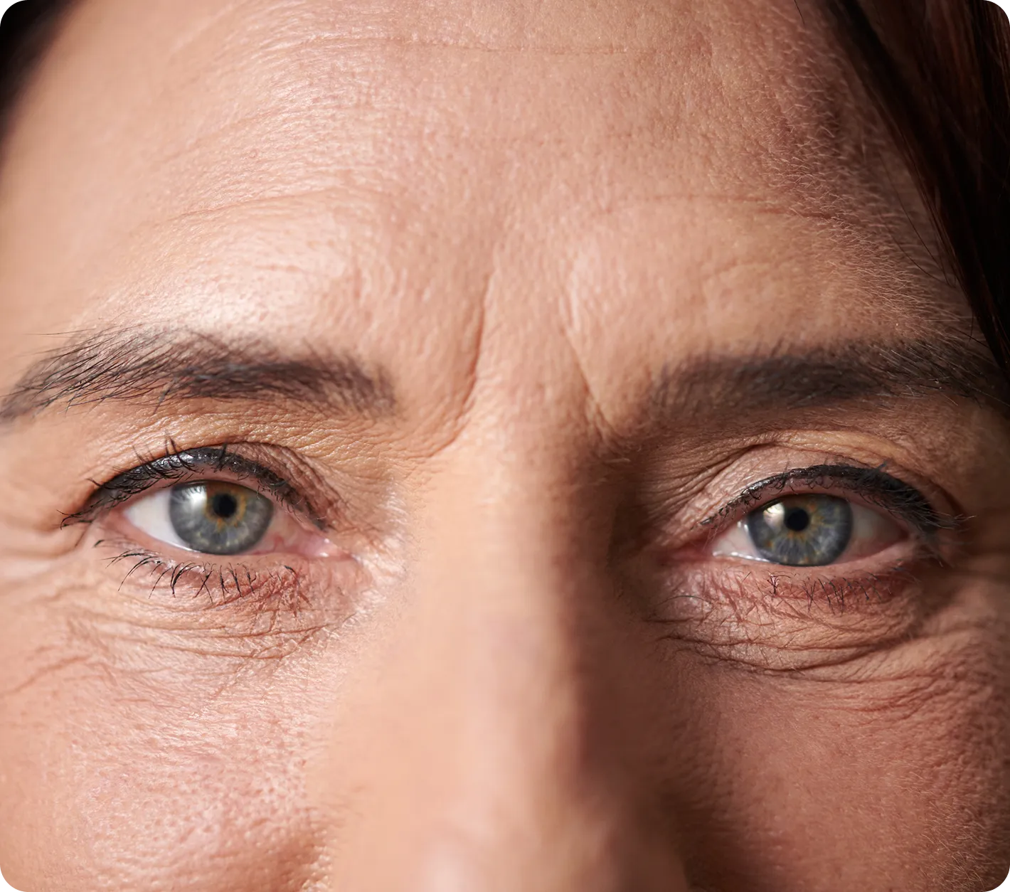 Non-Surgical Eye & Eyelid Treatments