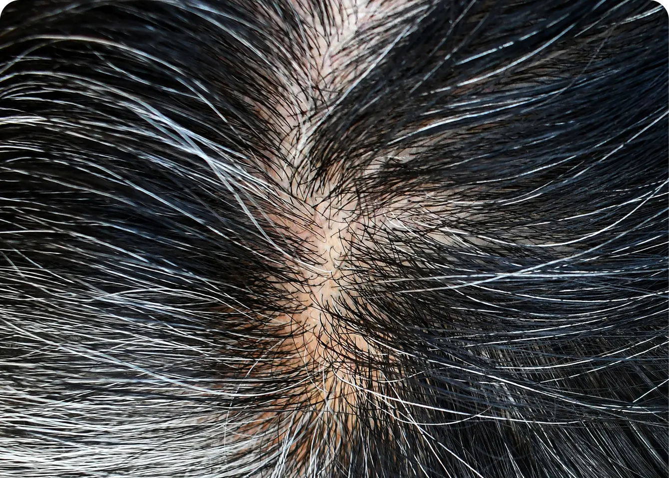 Hair Concerns