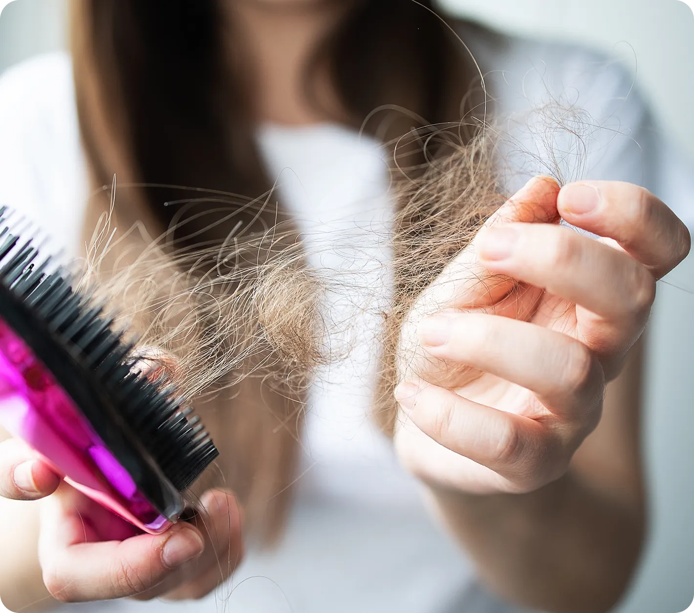 Hair Concerns