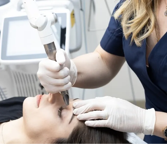 AlyneEye Fotona SmoothEye eyelid tightening at AlyneMD — non-invasive periocular rejuvenation