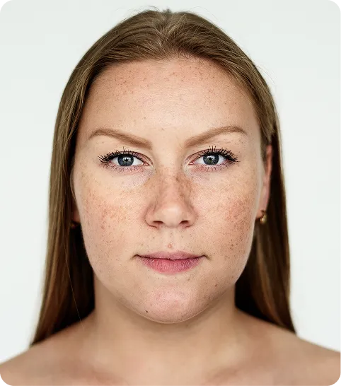 AlyneMD Laser Technology