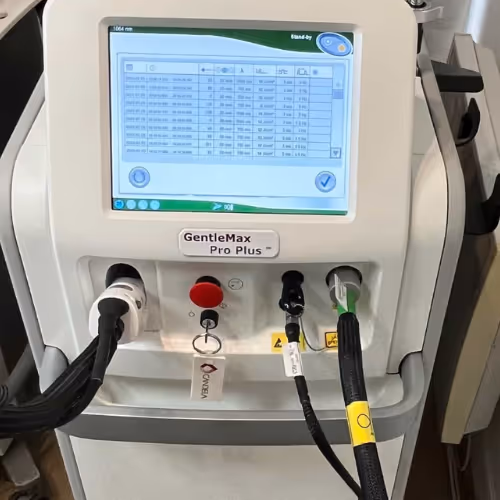 gentle max pro plus de centre laser murano - epilation laser