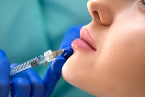 les injections d'acide hyaluronique des lèvres aux centres laser murano