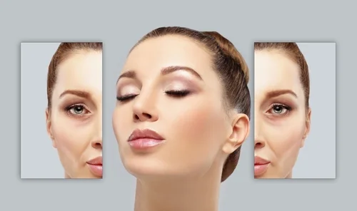 La Carboxythérapie sur le visage avec une image montrant les effets bénéfiques, aux Centres Laser Murano