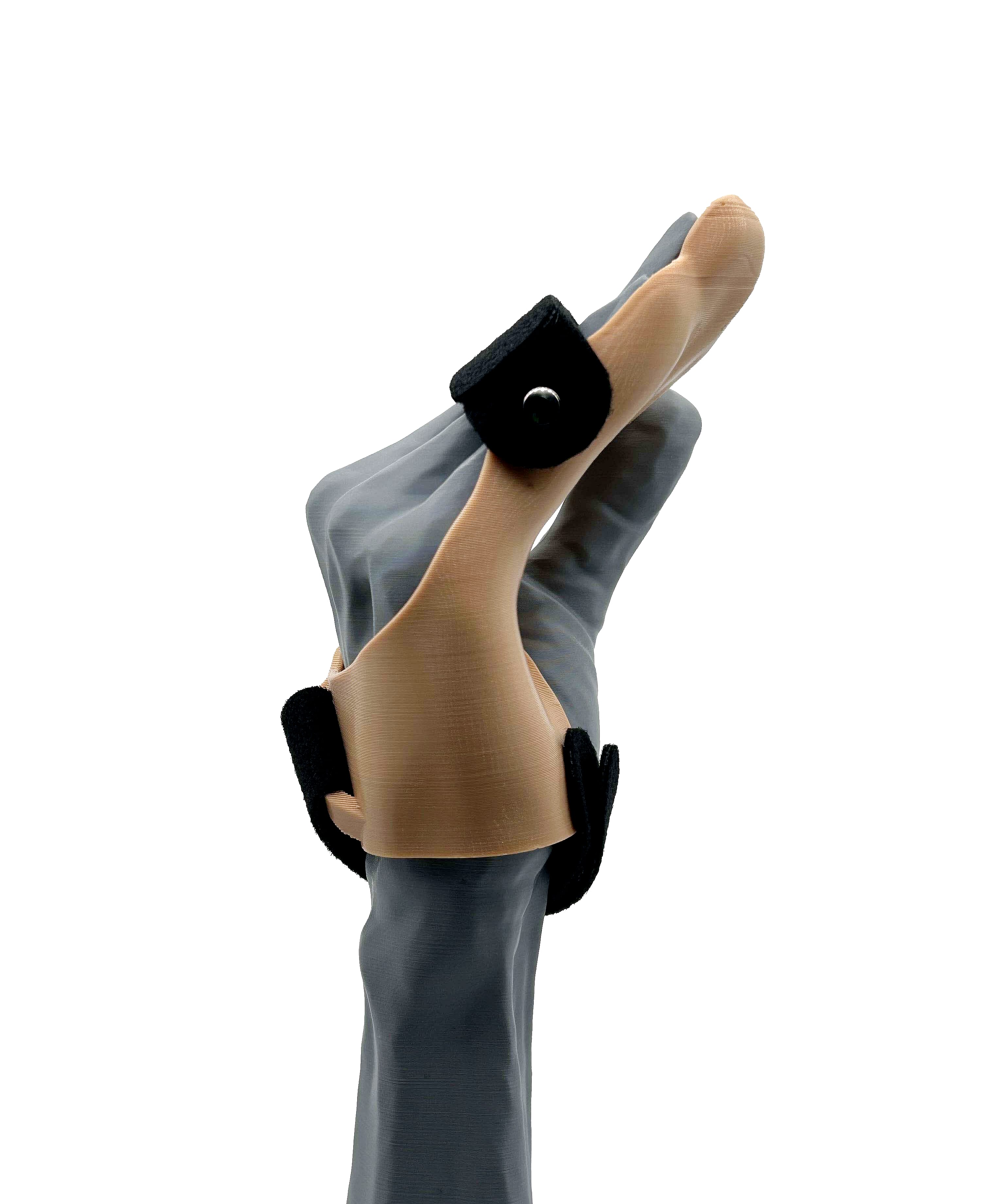 Intrinsic Plus Splint