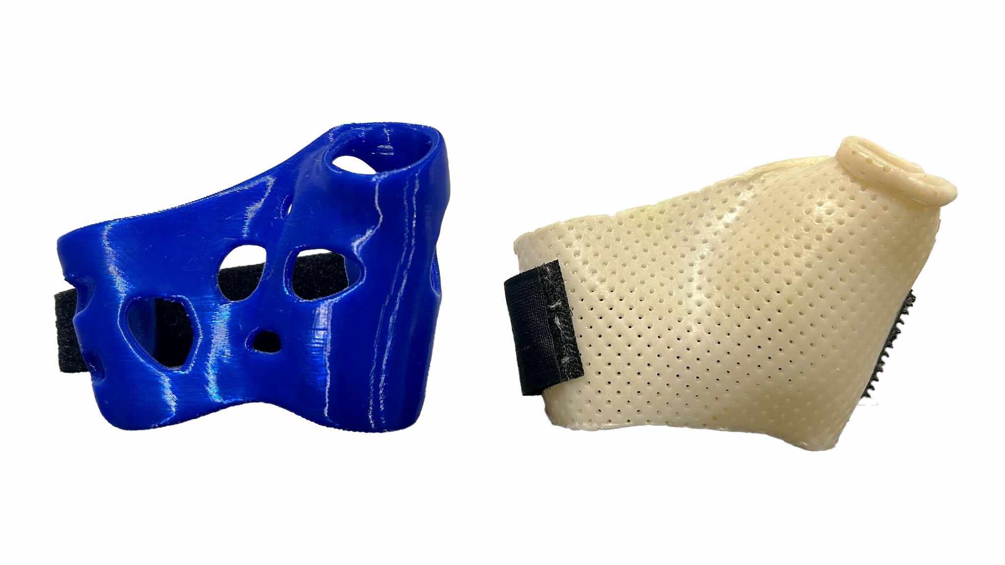 Comparison of 3D-printed splint and traditional thermoplastic splint