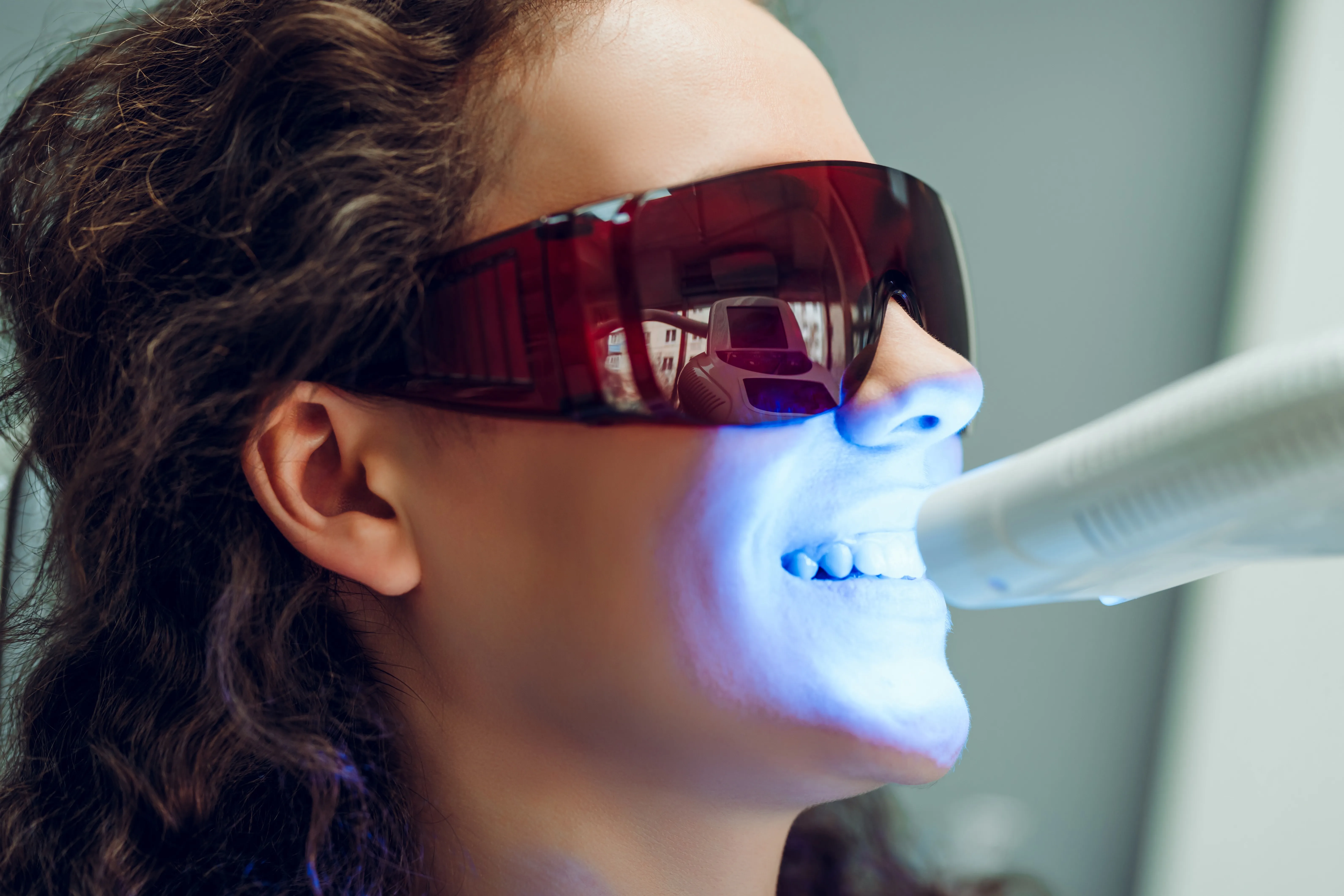 Patient receiving professional teeth whitening treatment at Legacy Dental Pasadena