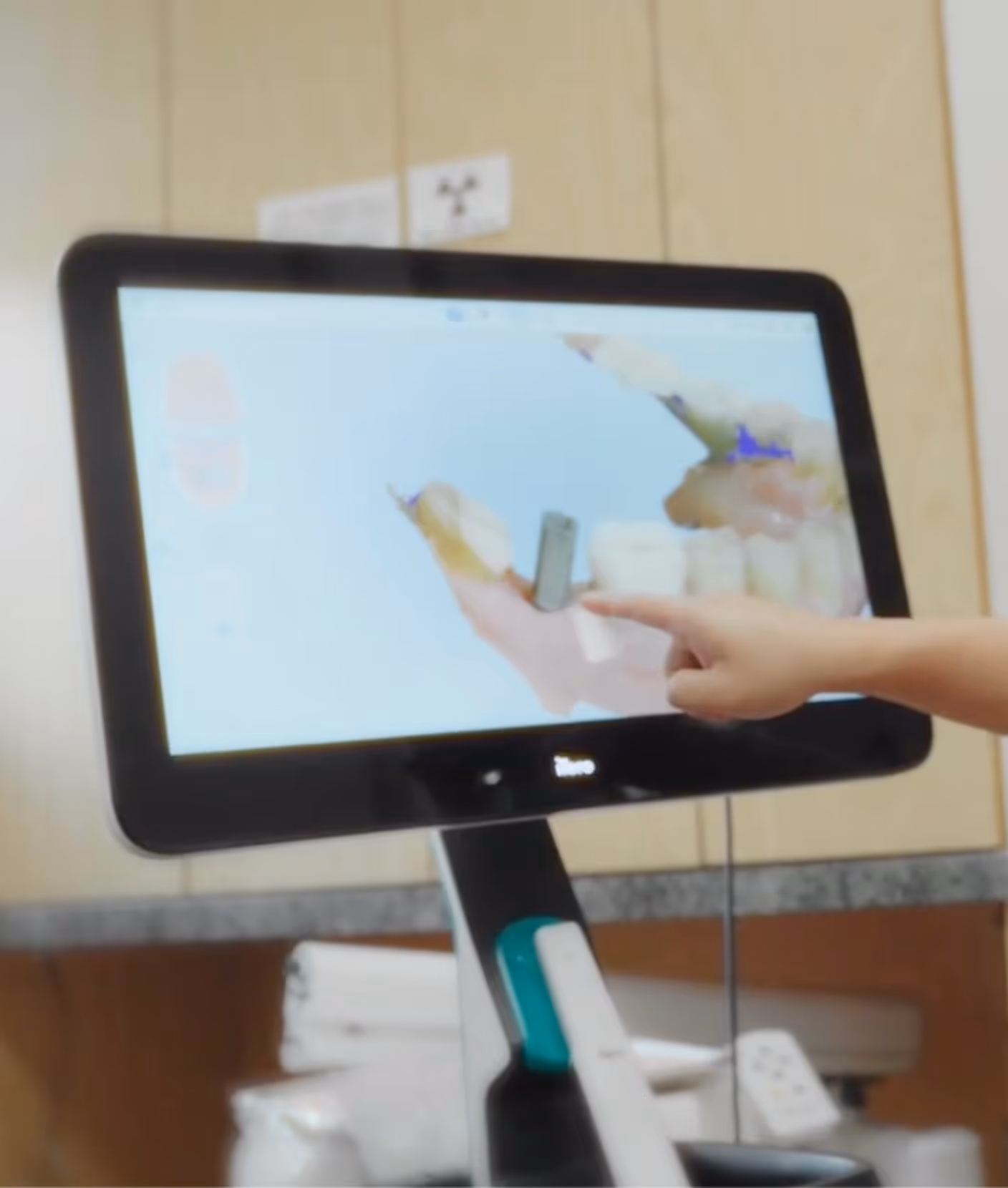 Digital iTero 5D scanner for accurate and comfortable dental impressions