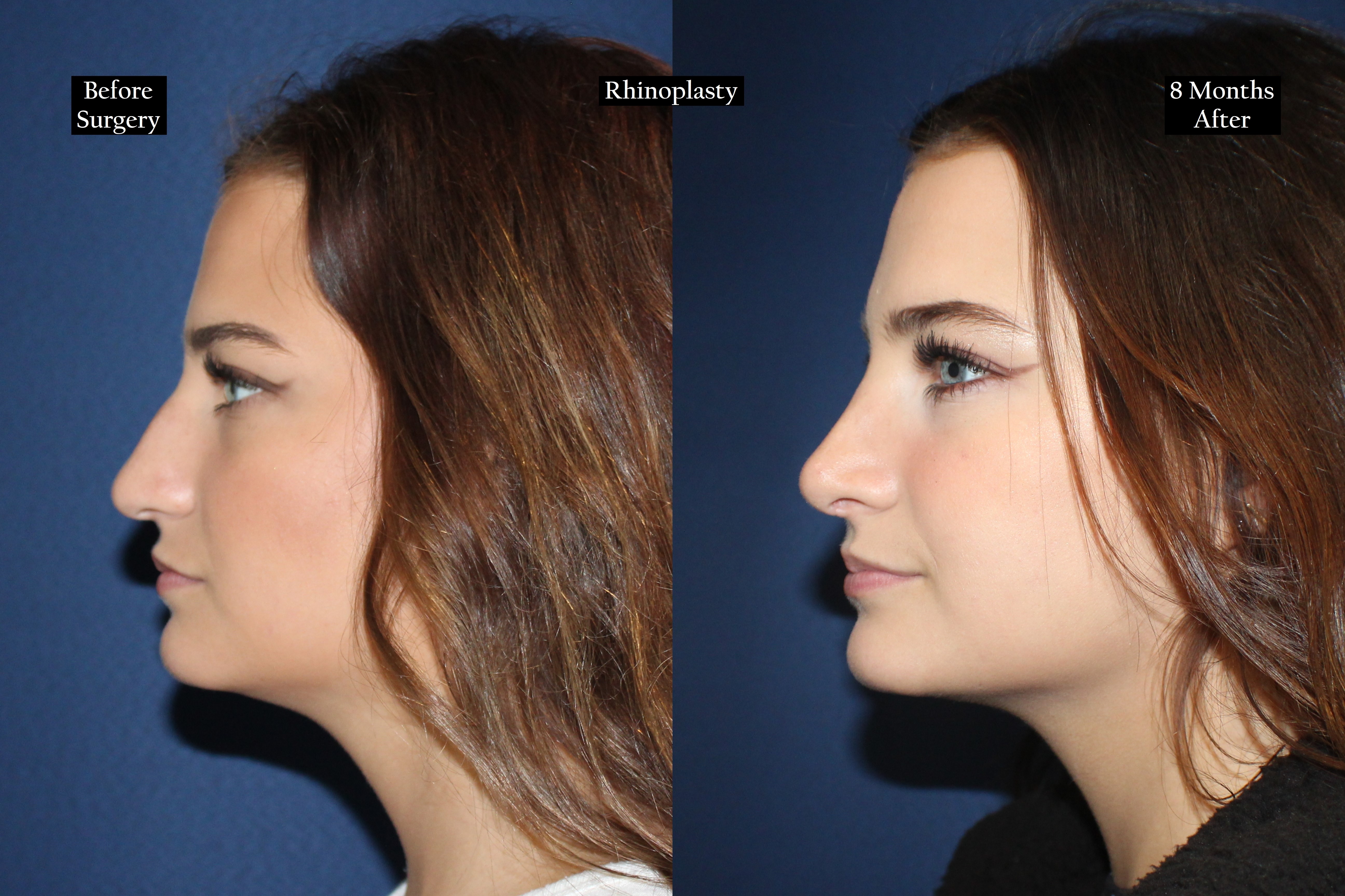 Before and after shot of a woman with auburn hair from the left
