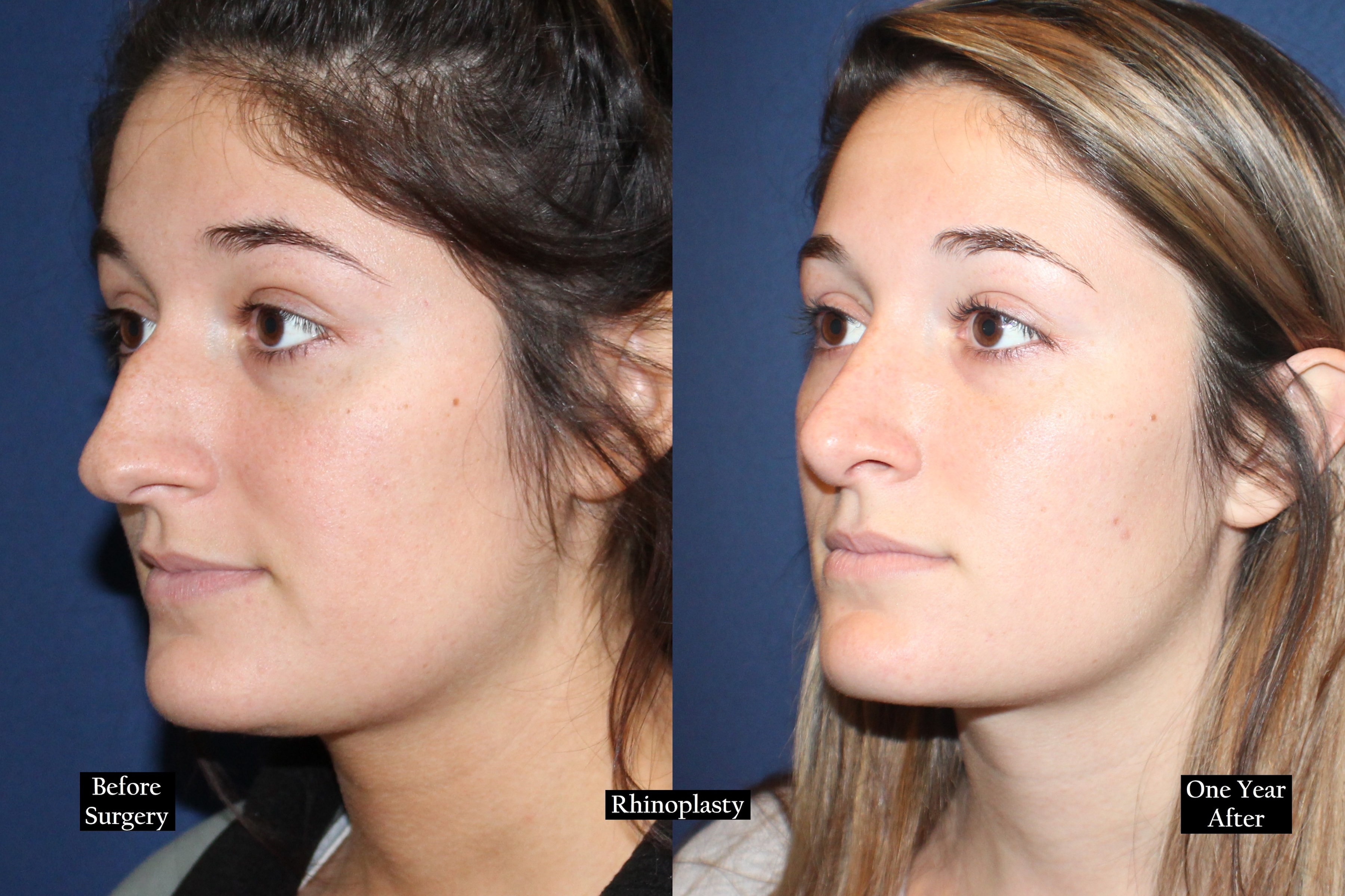 Before and after shot of a young woman with brown hair from an angle