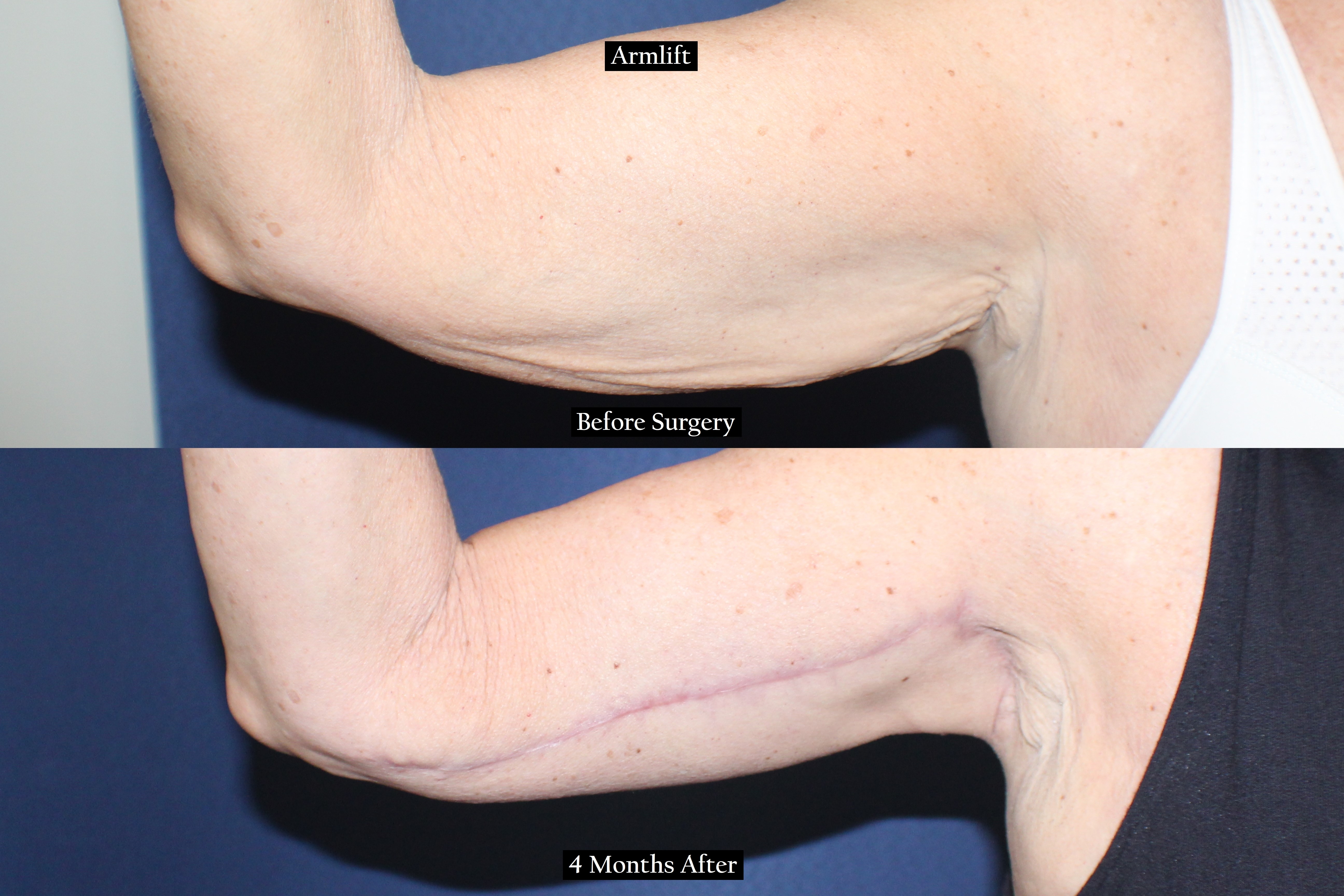 Before and after shot of