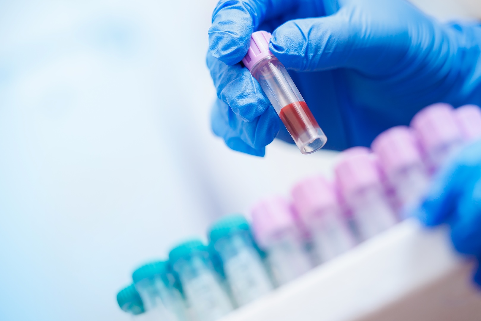 close up shot of test vials 