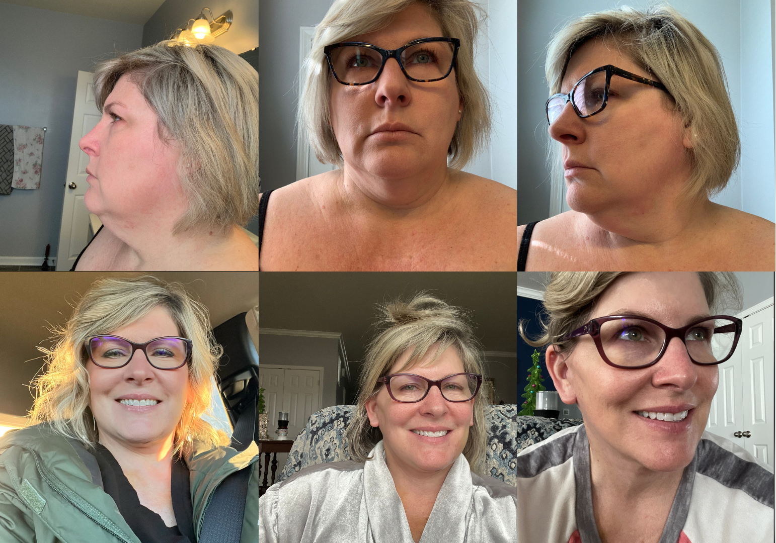 A collage of before and after shots of a smiling woman