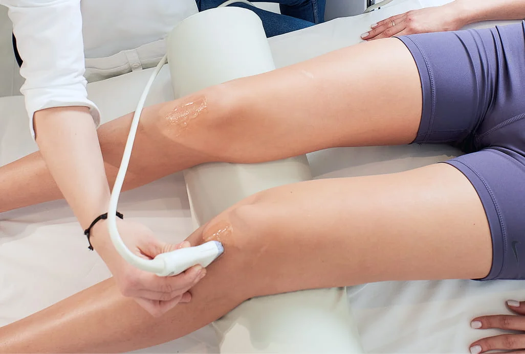 Спеціаліст проводить ультразвукове дослідження (УЗД) колінних суглобів пацієнтки. Ноги пацієнтки лежать на спеціальному медичному валику, на область колін нанесено прозорий провідний гель. Лікар тримає ультразвуковий датчик біля колінної чашечки для проведення діагностики.