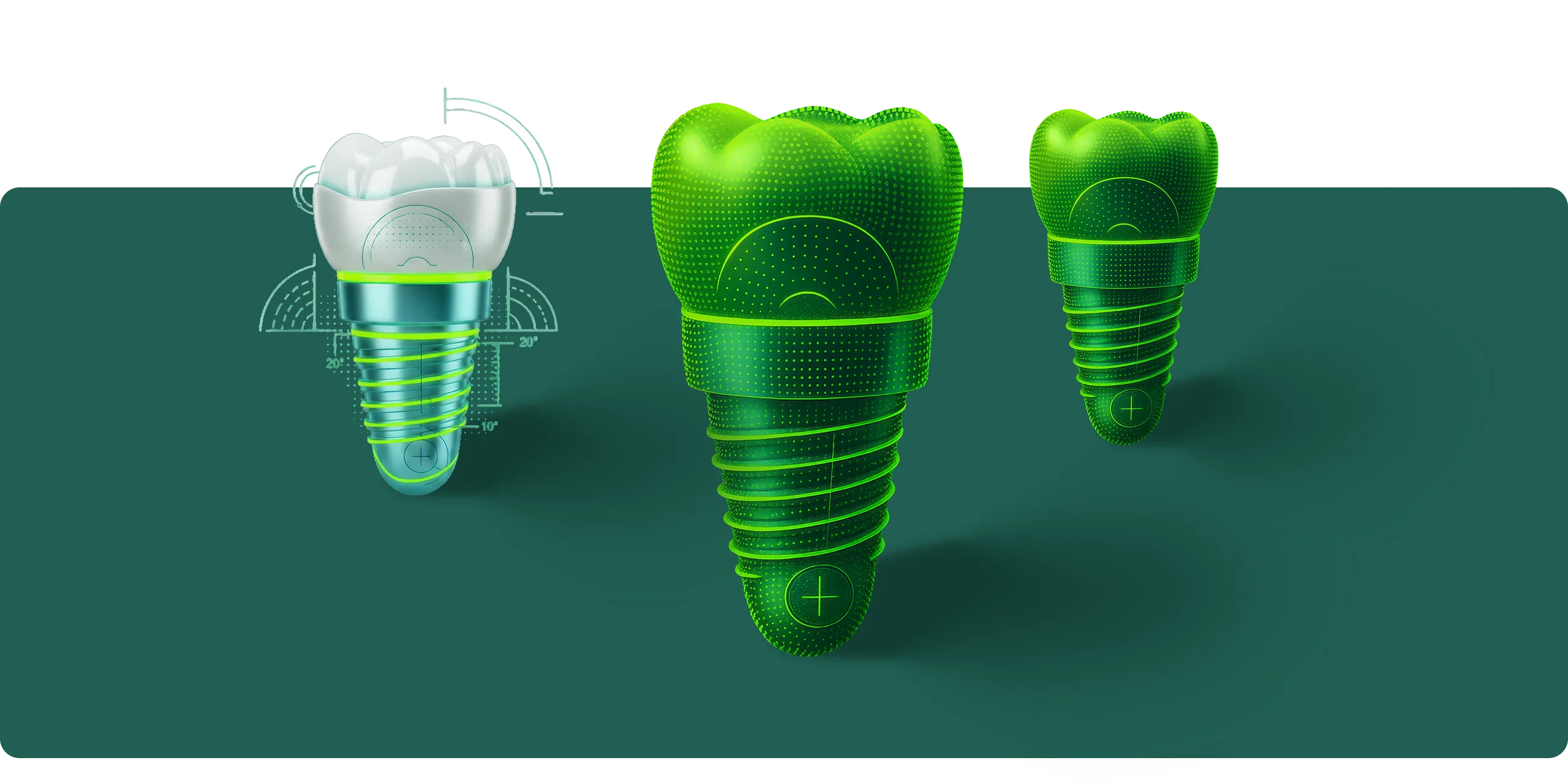 Implants image