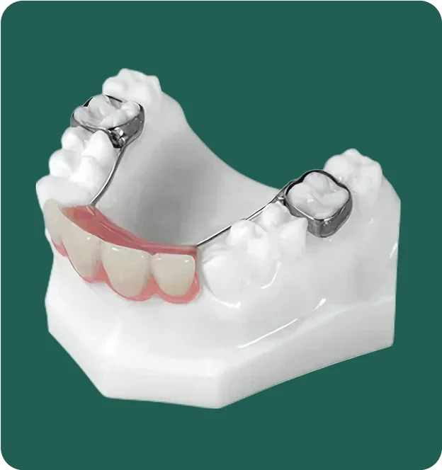 Photo of a dental prosthetics