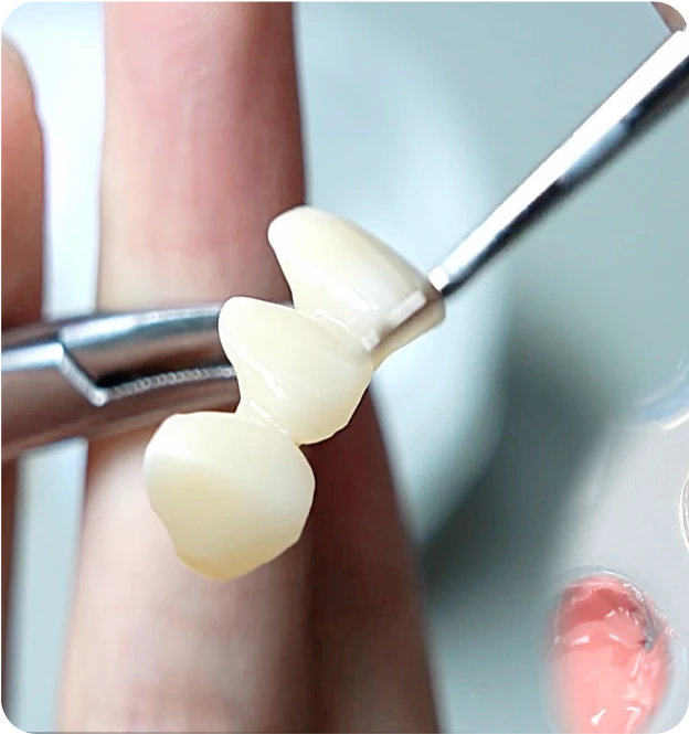 A photo of teeth prosthetics