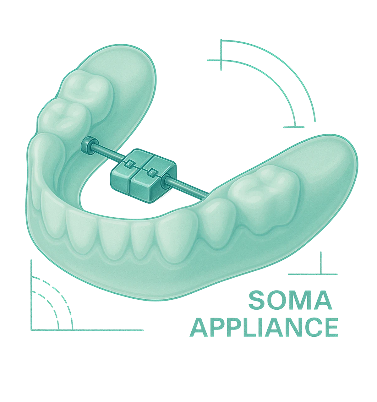 The SOMA Appliance Exclusively Manufactured by NovaDent Labs