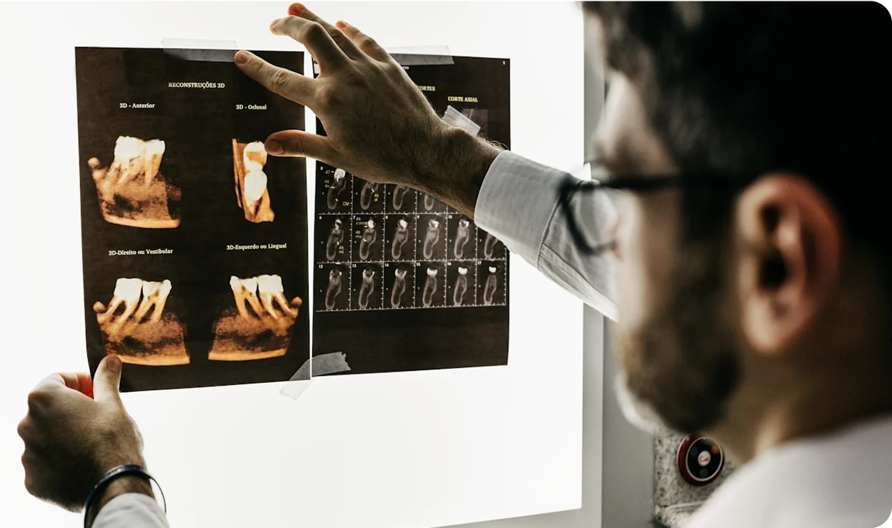 A dentist look at the a patient's x-ray of teeth