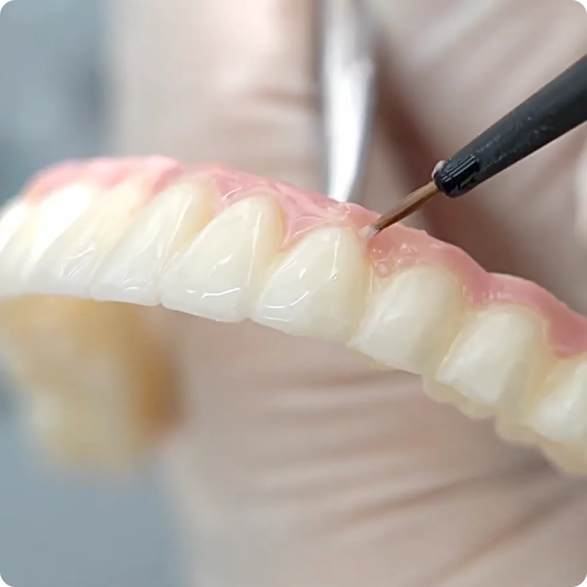 An image of teeth prosthetics
