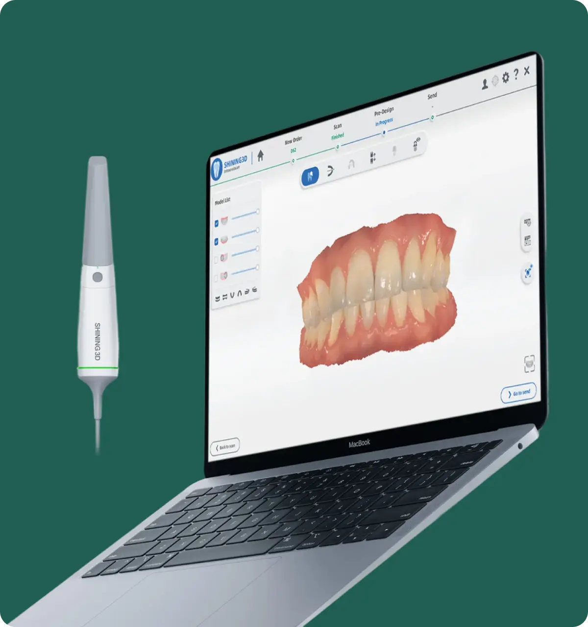 3D dental scanner beside a MacBook displaying a 3D digital model of human teeth on the screen.