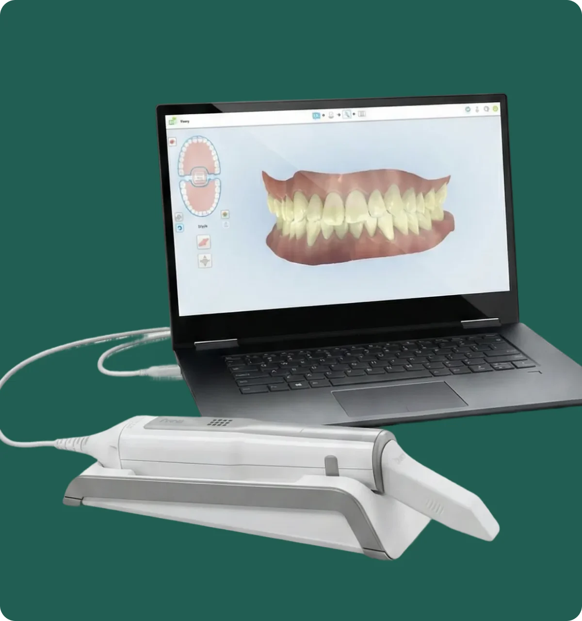 Laptop displaying a 3D digital model of teeth alongside a connected dental scanning device on a white stand.